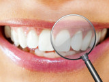Dental care